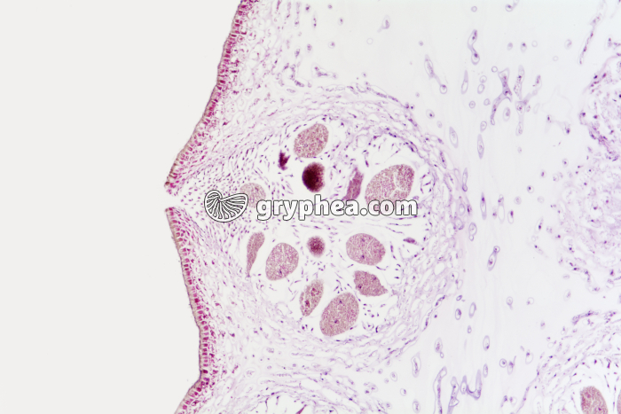 Fucus dioïque - conceptacle femelle en CL x20 - gryphea.org